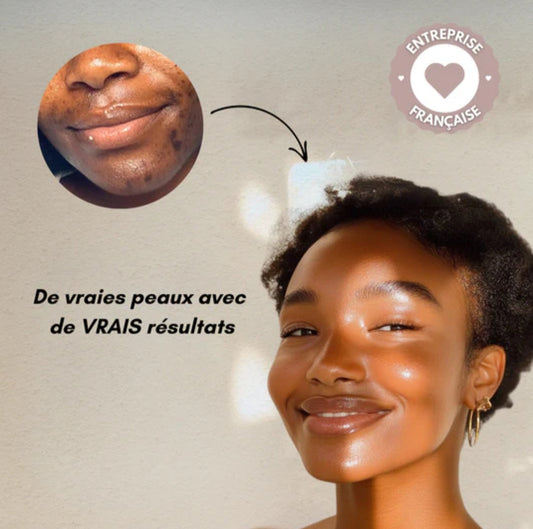 Lingettes nettoyantes au curcuma & acide kojique – Éclat naturel